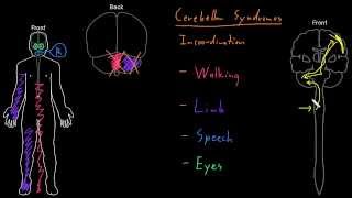 Syndrome Cerebellar syndromes [upl. by Lyman]