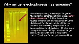 What taq polymerase 1 unit means [upl. by German21]