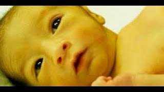 Signs of Pathologic Newborn Jaundice Neonatal Jaundice Hyperbilirubinemia Causes Symptoms [upl. by Odiug]