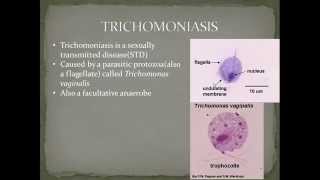 Parasitology Trichomoniasis Part 3 [upl. by Nylime550]