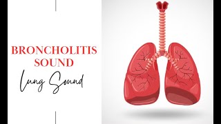 Bronchiolitis sound  Bronchiolitis Breathing Sound Bronchiolitis pediatrics [upl. by Anisor]