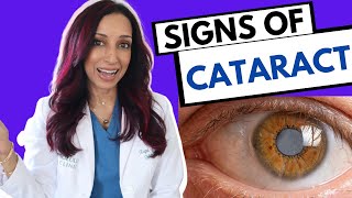 Signs of Cataracts  Eye Surgeon Explains [upl. by Benedix733]