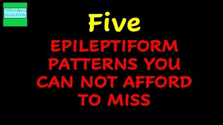 FIVE EPILEPTIFORM PATTERNS THAT YOU SHOULD NEVER MISS [upl. by Inig]