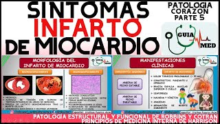 QUÉ ES UN INFARTO AGUDO AL MIOCARDIO SIGNOS Y SÍNTOMAS  GuiaMed [upl. by Sirovart523]