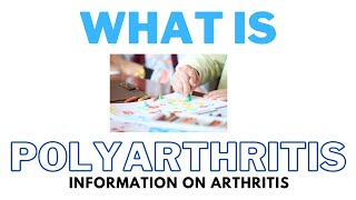 What Is Polyarthritis  The Cause The Symptoms amp The Diagnosis [upl. by Eugirne21]