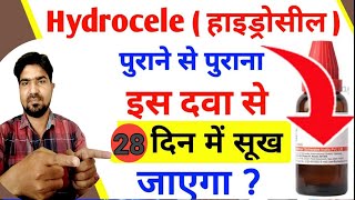 Hydrocele  Homeopathic medicine in Hydrocele  हाइड्रोसिल [upl. by Keram]