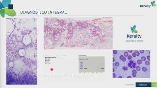 Experiencia en el diagnóstico integral de leucemias y linfomas en Colombia  BD [upl. by French893]