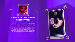 Esophageal varices [upl. by Aseyt]