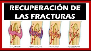 Consolidación de las Fracturas 🦴 Tiempo Fases [upl. by Fulks225]