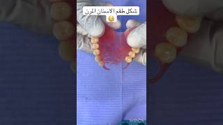 شوف شكل طقم الاسنان المرنFlexible denture أفضل طقم اسنان طقماسنانdentaldenture [upl. by Kristel]