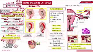 El ABORTO TIPOS Y CAUSAS MAS FRECUENTES [upl. by Gianina243]