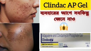 Clindac AP Gel এর বাংলা রিভিউAdapalene and clindamycin Phosphate Gel মাত্র 7 দিনে ত্বক ফর্সা করবে [upl. by Nikral]