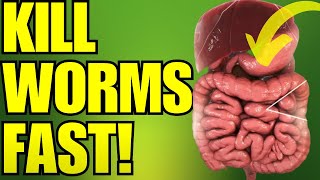 20 EASY Ways to Get Rid of Intestinal Worms and Parasites from Your Body [upl. by Erdna627]