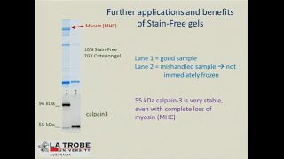 SingleCell Western Blot and StainFree Total Protein Loading Control [upl. by Iht]