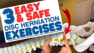 3 EASY amp SAFE L5S1 Disc Herniation Exercises amp L4L5  Dr Marc Dupuis Chiropractor in Sanford ME [upl. by Esirec426]