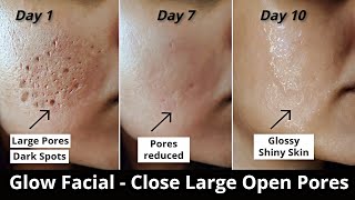 Get Rid of Hyperpigmentation Scars Dark Spots amp Boil Scars on Your Body FAST  Highly Requested [upl. by Neleh486]