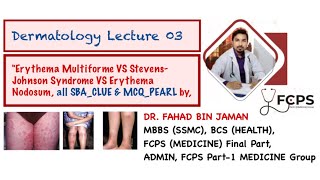 Erythema Multiforme VS SJS VS Erythema Nodosum all differentiating SBA amp MCQ ClueDrFahadFCPSP1MG [upl. by Eniahs]