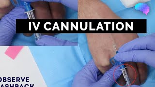 Intravenous IV cannulation  OSCE Guide  UKMLA  CPSA [upl. by Mehsah]