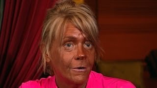 Tanning Mom In Court Denies Daughter 5 Burned in Tan Salon Does She Suffer from Tanorexia [upl. by Drawd]