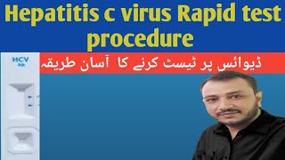 Hcv test procedure Hepatitis c virus test [upl. by Zamora]