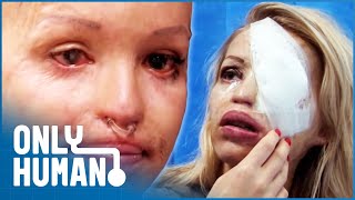 Katie Piper Faces More Surgery On Her Eyelids Leaving Her Temporarily Blind  Only Human [upl. by Livvi]