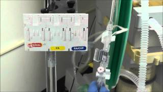 How to Setup an Arterial Line Transducer [upl. by Frankhouse]