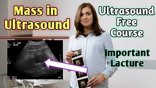 Can masses be seen on ultrasound  Does hypoechoic mass mean cancer [upl. by Initirb646]