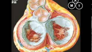 Animated Mitral Regurgitation Murmur [upl. by Melania354]