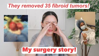 My Crazy Uterine Fibroid Surgery  Story Time  Massive Fibroid Tumors Journey  Myomectomy Postop [upl. by Duky690]