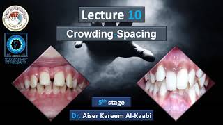 Crowding and Spacing in orthodontics lec10 stage 5 [upl. by Aiekat]