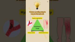 Virchow’s Triad  Factors Predisposing to Thrombosis [upl. by Schach937]