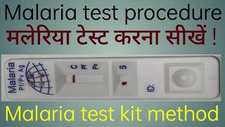 Malaria test kit method  Malaria test procedure  Malaria test kaise kiya jata hai [upl. by Grossman]