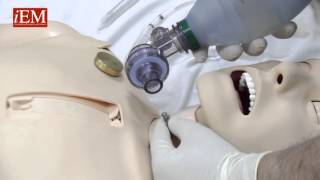 Simple Needle Cricothyroidotomy Options [upl. by Bergstrom]