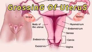 Grossing Of Uterus।। grossinguteruspathology [upl. by Leanne]