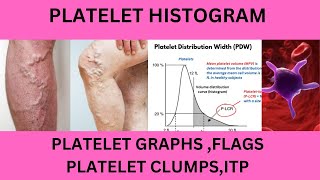 PLATELET HISTOGRAMPLATELET GRAPHPLATELET INDICESPLATELET FLAGSPLTPLT LCRPLTMP FLAGPUPL FLAG [upl. by Eulalie]