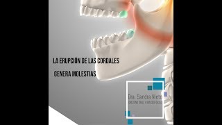 Extracción de Cordales  Dra Sandra Nieto Cirujana Oral y Maxilofacial [upl. by Notfilc723]