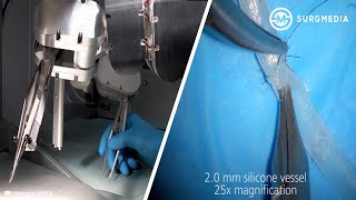 World’s First Clinically Available Microsurgical Robotic System SuperMicrosurgery with Robot Hands [upl. by Yennek]