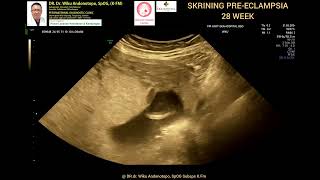 Skrining PreEclampsia 28 weeks [upl. by Stoddart]