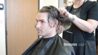 Mens Hair Restoration San Diego Orange County [upl. by Nonnarb]