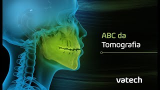 LIVE Vatech  ABC da Tomografia Odontológica  Noções básicas e principais dúvidas [upl. by Natsirt]