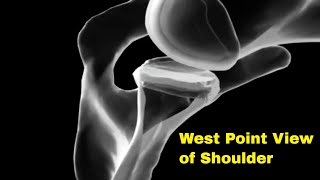 West point view of the shoulder [upl. by Atiek]