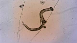 Root knot nematode was captured with nematophagous fungus [upl. by Brittan305]