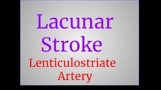 Lacunar Stroke [upl. by Dibbrun]