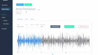 Eko Digital Stethoscope  Atrial Fibrillation [upl. by Limaj]