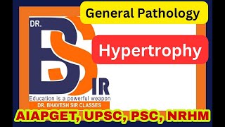 Hypertrophy  General Pathology  DrBhavesh Sir Classes I DrBhavesh Sir Pharmacy [upl. by Aver745]