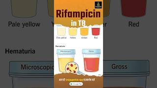 What is Rifampicin  Rifampicin in TB rifampicin nursing testpaperlivenursing shortvideo aiims [upl. by Nnyw]