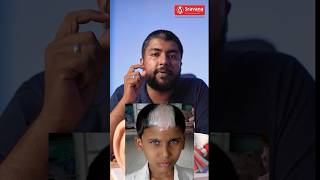 ജന്മനാ കേൾവിക്കുറവുള്ള കുട്ടികൾ  Waardenburg Syndrome hearingloss genetics shorts child ear [upl. by Kelwen]