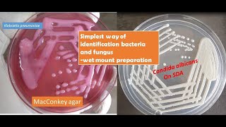 A very simple Saline wet mount techniue help you to identify yeast cells of candida from bacteria [upl. by Olag]