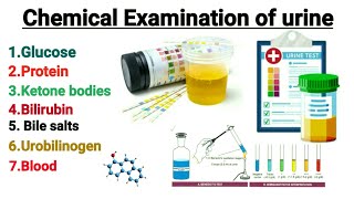 Chemical Examination of urine  Urine analysis  Glucose in urine  Glycosuria Explain in hindi [upl. by Luiza61]