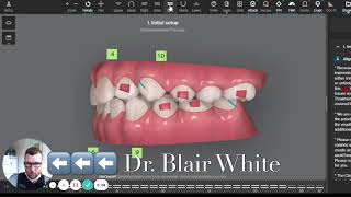 The Invisalign® ClinCheck Process [upl. by Hayton]